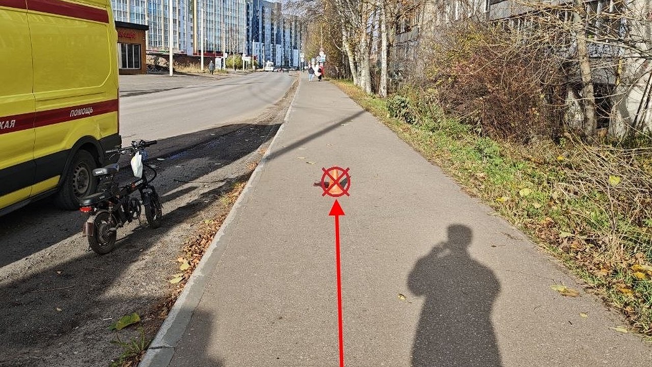 Главная картинка новости: В Коми мужчина на электровелосипеде упал на тротуаре и получил травмы