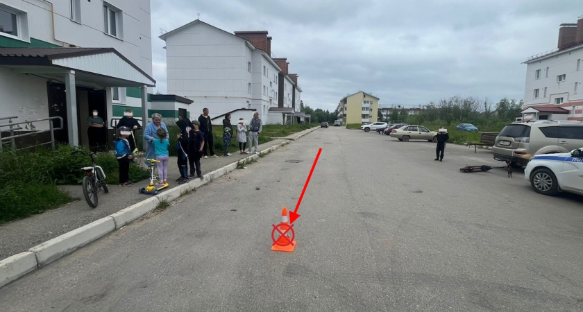В Коми ребенок на мощном электросамокате сбил школьницу